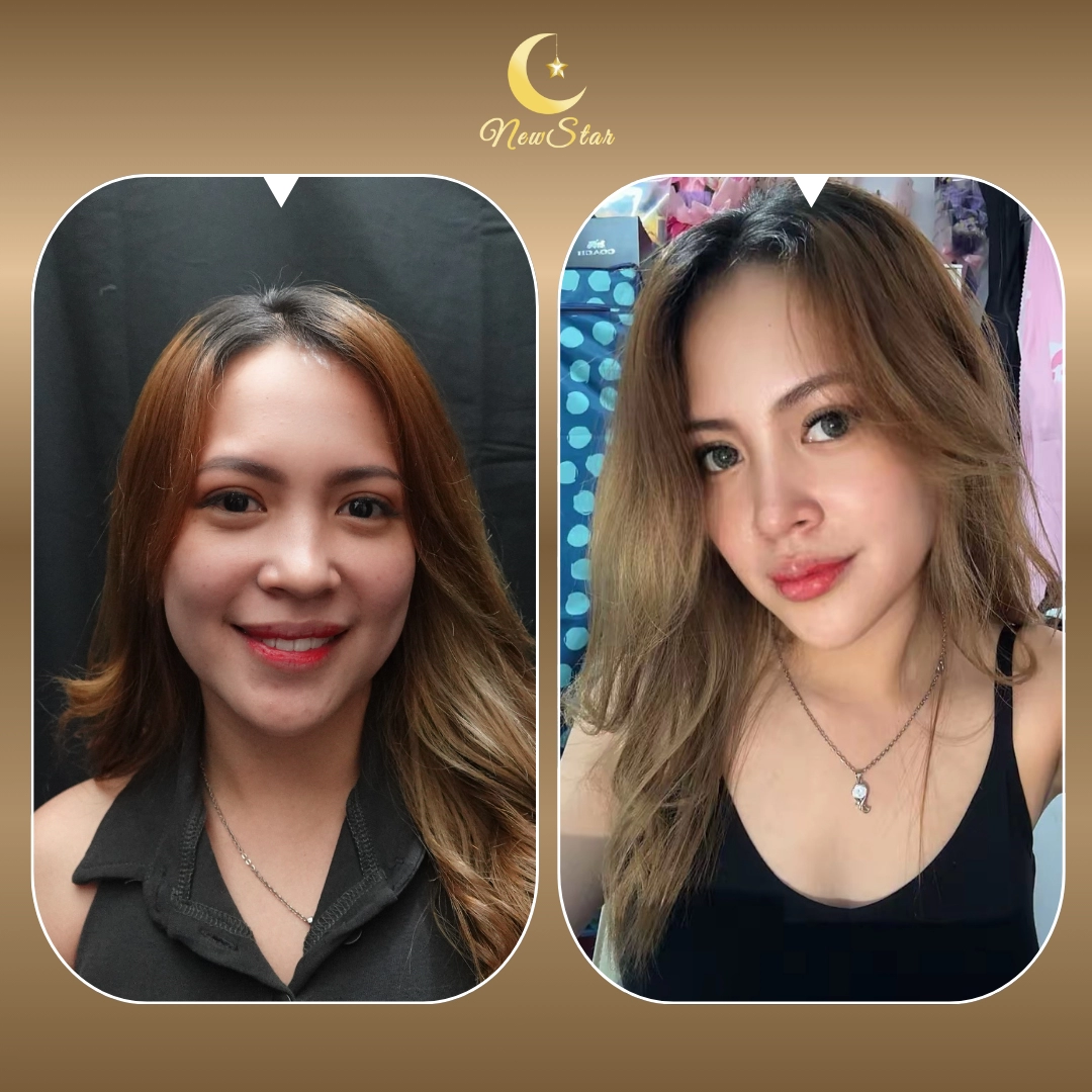 FILLER BIBIR